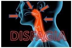 ¿Qué es la disfagia y cuáles son sus signos y síntomas?